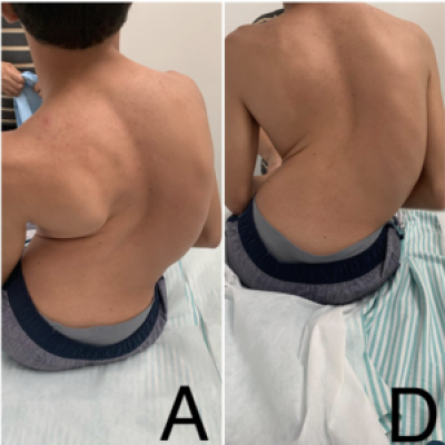 Correção Postural por Micro-Toques