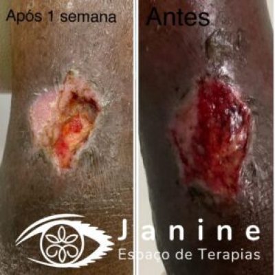 Ilibe Terapia